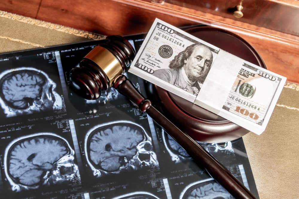 The image highlights brain injury law, showcasing a blend of legal and medical concepts.