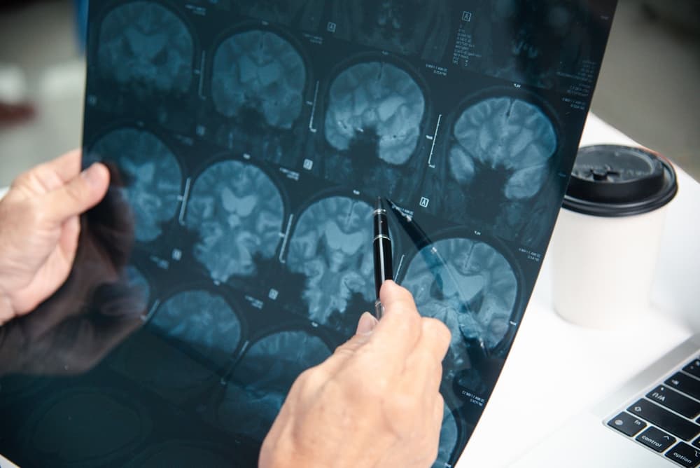 doctor is diagnosing brain injuries using x-ray films.